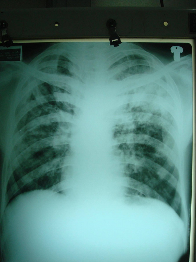 1000 hình ảnh x quang lâm sàng, hướng dẫn các bước đọc phim x-quang